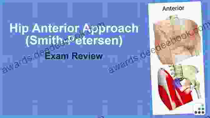 Anterior Hip Exposure (Smith Petersen Approach) Master Techniques In Orthopaedic Surgery: Relevant Surgical Exposures