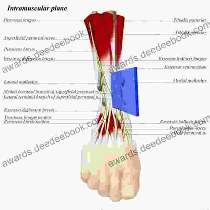 Medial Ankle Exposure (Deltoid Approach) Master Techniques In Orthopaedic Surgery: Relevant Surgical Exposures