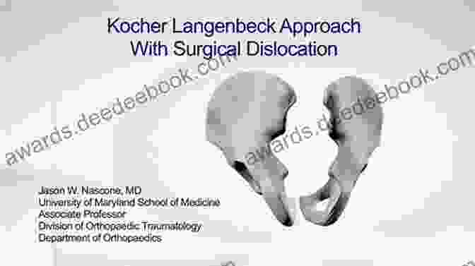 Posterior Hip Exposure (Kocher Langenbeck Approach) Master Techniques In Orthopaedic Surgery: Relevant Surgical Exposures