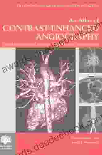 Atlas Of Contrast Enhanced Angiography (Encyclopedia Of Visual Medicine 57)