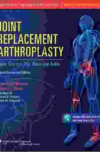 Joint Replacement Arthroplasty: Basic Science Hip Knee and Ankle