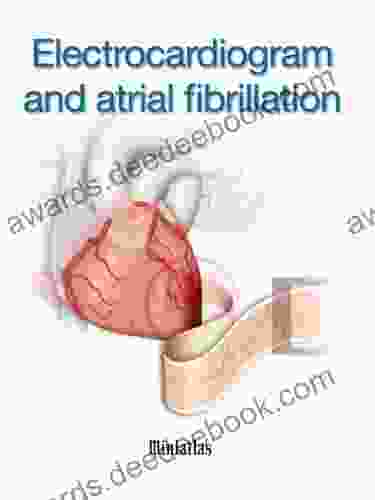 Electrocardiogram And Atrial Fibrillation Miniatlas